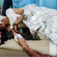 اليمن: التحالف يقصف حافلة تقل أطفالاً مقتل وجرح العشرات
