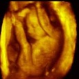 تثاؤب الجنين في بطن الأم عملية مرتبطة بنموه