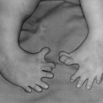 ألمانيا تقرر زيادة تعويضات المتضررين من عقار Thalidomide