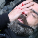 فرنسا: إصابة أحد القادة المعروفين لحركة 
